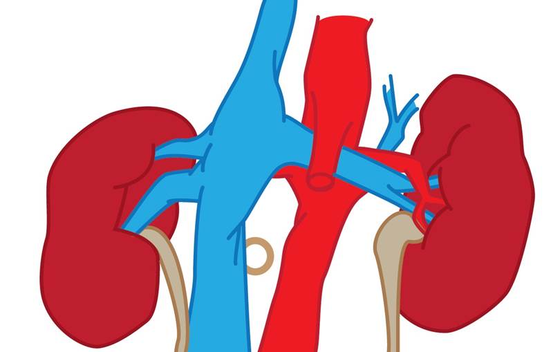 Um rannsókn á algengi langvinns nýrnasjúkdóms á Íslandi í Kidney International