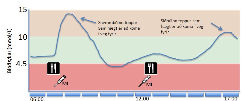 Að tímasetja insúlíngjafir rétt